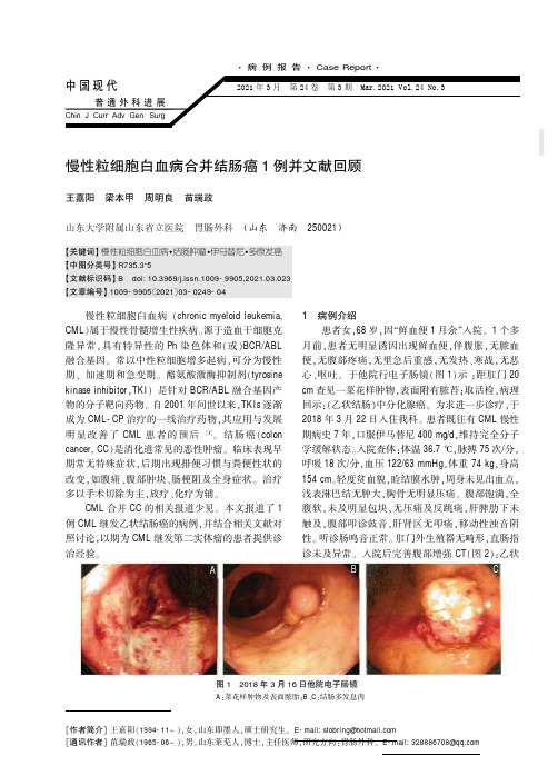 慢性粒细胞白血病合并结肠癌1例并文献回顾