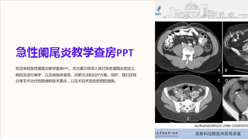 急性阑尾炎教学查房PPT