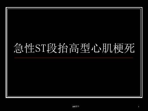 急性ST段抬高型心肌梗死  ppt课件