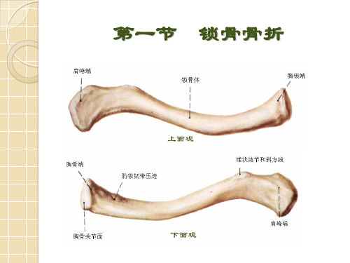 上肢骨关节损伤PPT课件