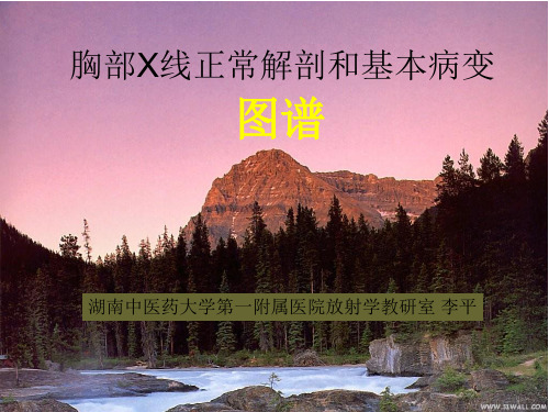 胸部X线诊断图谱(总论)