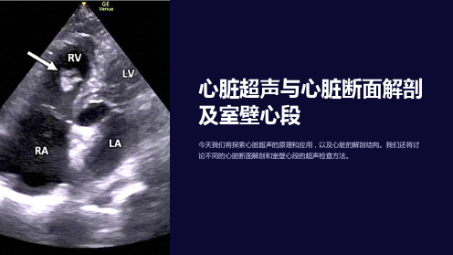 心脏超声与心脏断面解剖及室壁心段