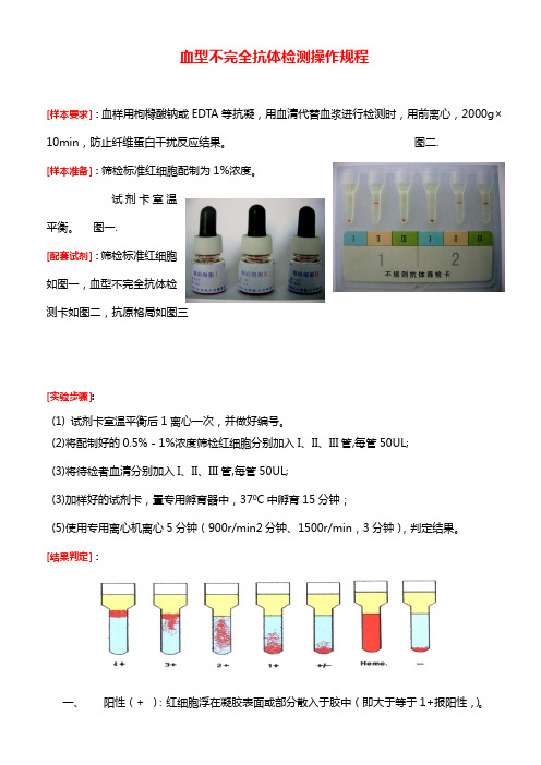 不完全抗体筛检操作规程