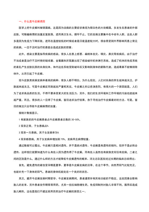 牛皮癣常识及注意事项