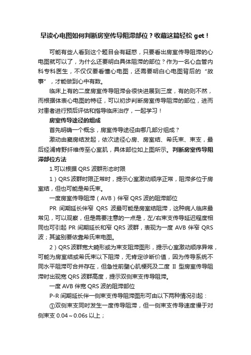 早读心电图如何判断房室传导阻滞部位？收藏这篇轻松get！