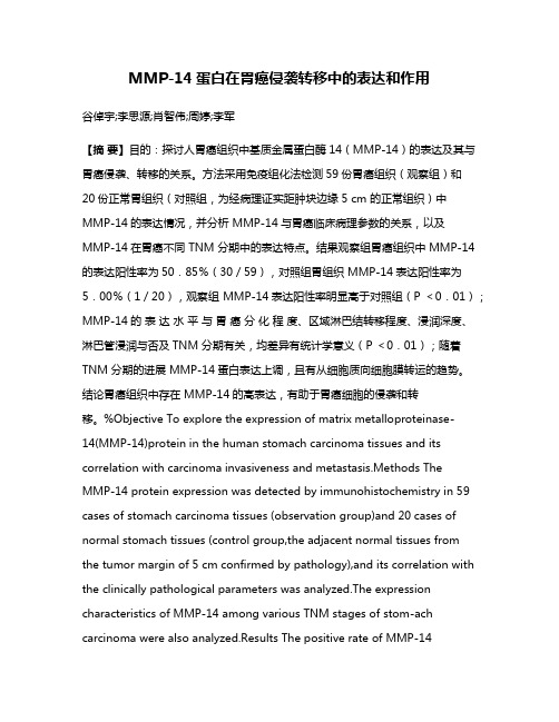 MMP-14蛋白在胃癌侵袭转移中的表达和作用