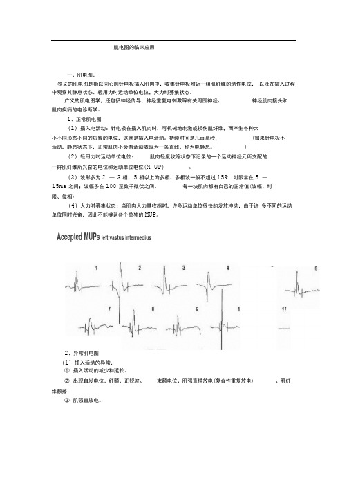 肌电图的临床应用.