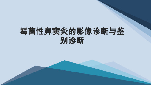 霉菌性鼻窦炎的影像诊断与鉴别诊断