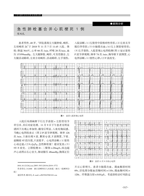 急性肺栓塞合并心肌梗死1例