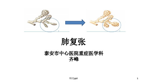 齐峰肺复张