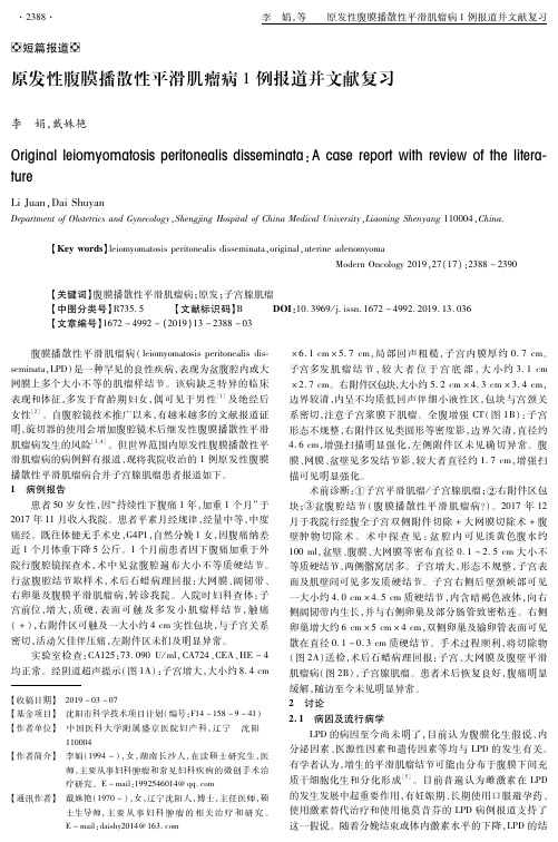 原发性腹膜播散性平滑肌瘤病1例报道并文献复习