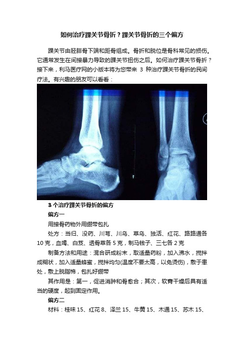 如何治疗踝关节骨折？踝关节骨折的三个偏方