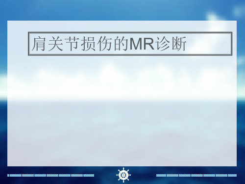 肩关节损伤的MR诊断  ppt课件