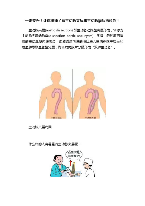 一定要看！让你迅速了解主动脉夹层和主动脉瘤超声诊断！