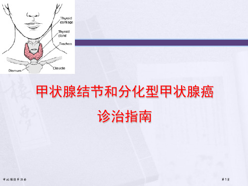 甲状腺结节指南