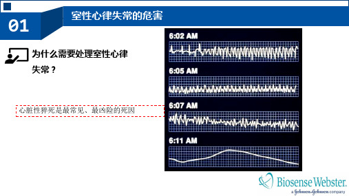 室性心律失常的射频消融治疗培训课件