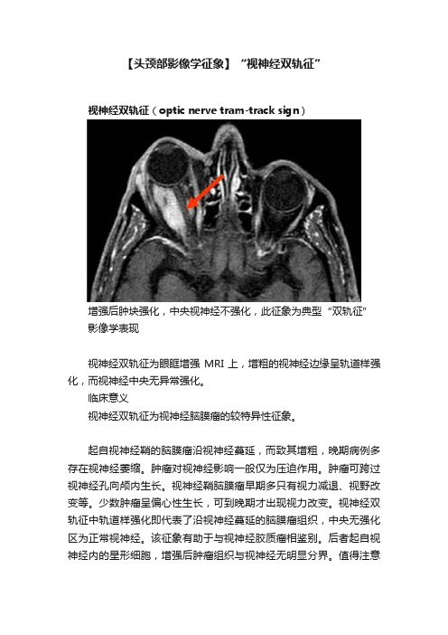 【头颈部影像学征象】“视神经双轨征”