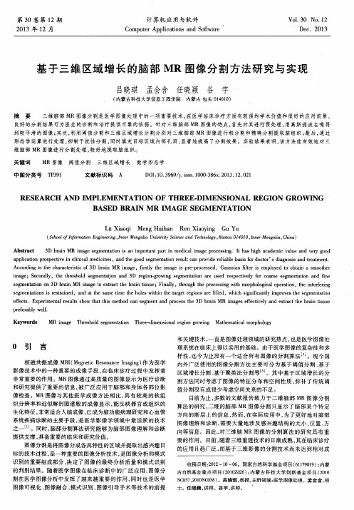 基于三维区域增长的脑部 MR 图像分割方法研究与实现