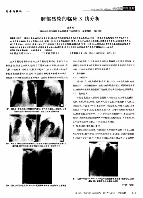 肺部感染的临床X线分析