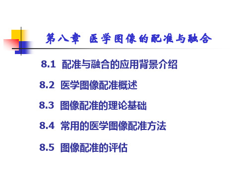 医学图像的配准与融合.ppt