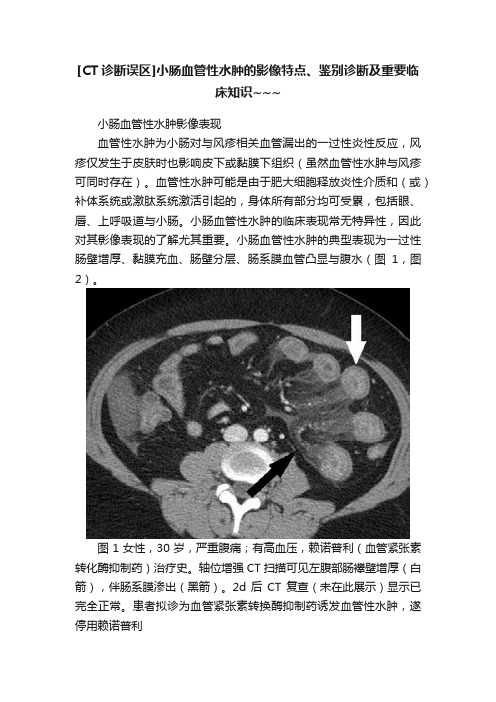 [CT诊断误区]小肠血管性水肿的影像特点、鉴别诊断及重要临床知识~~~