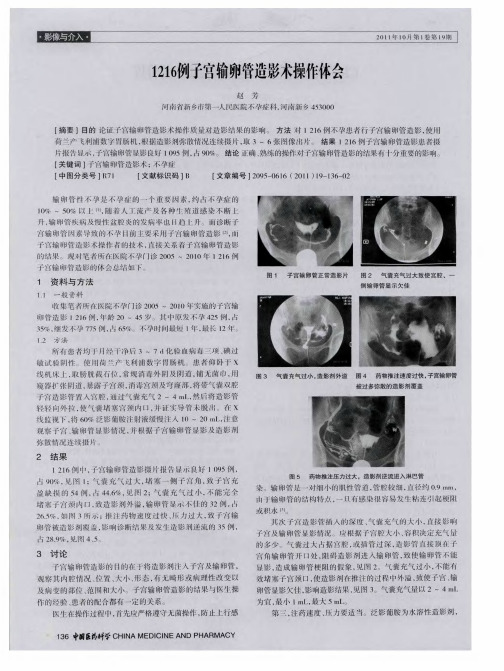 1216例子宫输卵管造影术操作体会