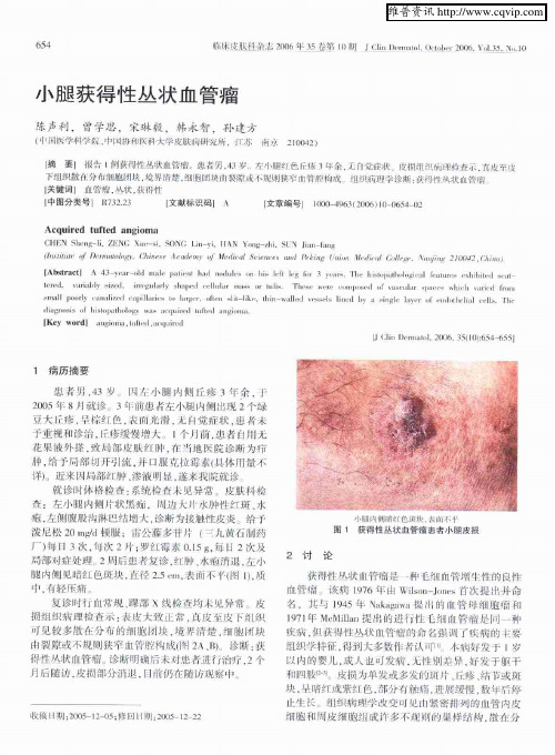 小腿获得性丛状血管瘤