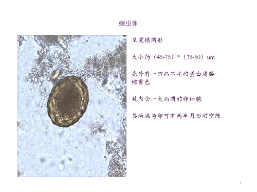 寄生虫学虫卵总结及图片1ppt课件