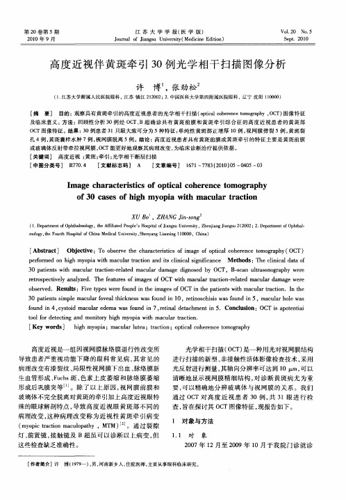 高度近视伴黄斑牵引30例光学相干扫描图像分析