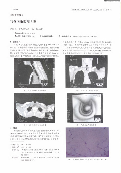 气管内脂肪瘤1例