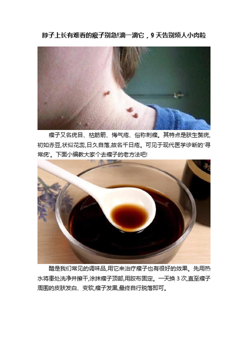 脖子上长有难看的瘊子别急!滴一滴它，9天告别烦人小肉粒