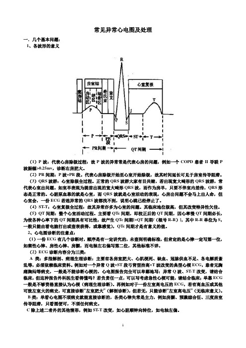 常见异常心电图及处理