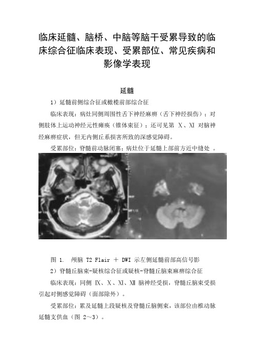 临床延髓、脑桥、中脑等脑干受累导致的临床综合征临床表现、受累部位、常见疾病和影像学表现