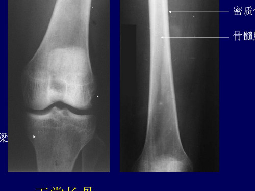 上肢骨影像解剖 PPT