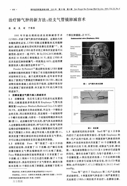 治疗肺气肿的新方法:经支气管镜肺减容术