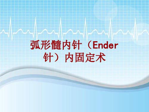 手术讲解模板：弧形髓内针(Ender针)内固定术