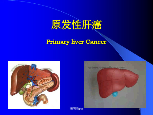原发性肝癌最新PPT课件