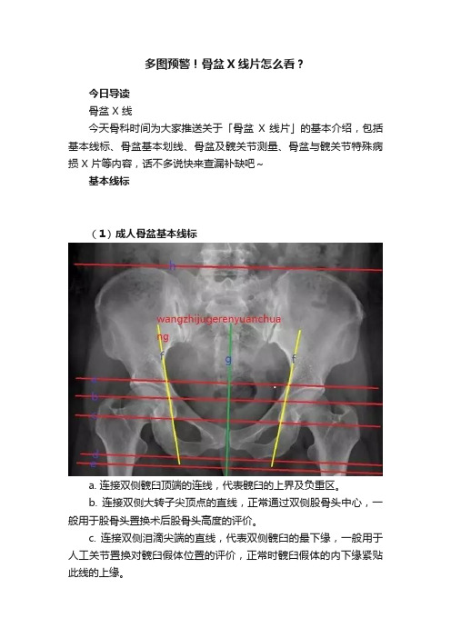 多图预警！骨盆X线片怎么看？