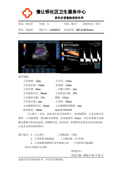 心脏-彩超报告单