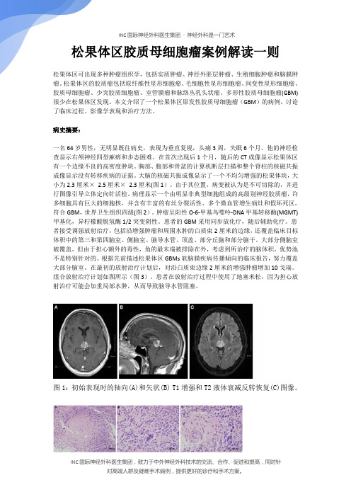 松果体区胶质母细胞瘤案例解读一则