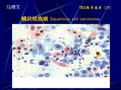 宫颈液基脱落细胞学图库TBS分类1_13ppt课件