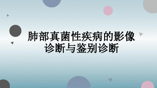 肺部真菌性疾病的影像诊断与鉴别诊断