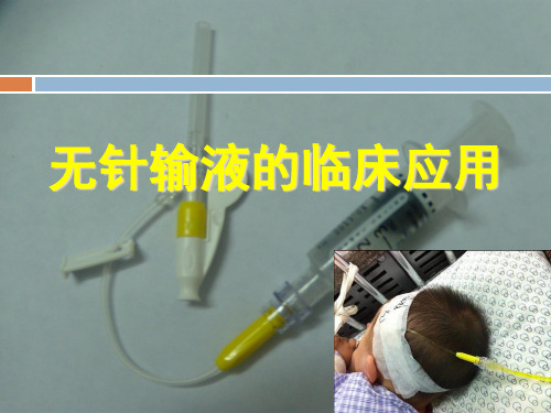 无针输液理念精品PPT课件