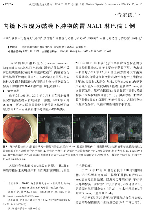 内镜下表现为黏膜下肿物的胃MALT淋巴瘤1例