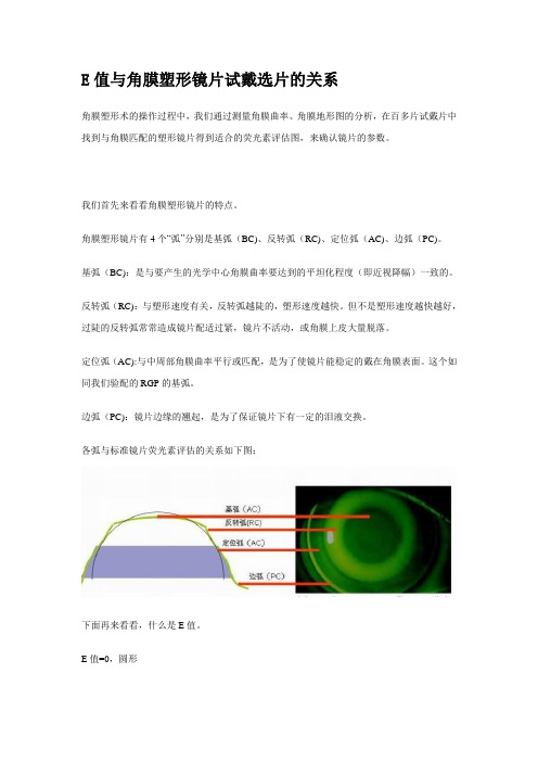 E值与角膜塑形镜片试戴选片的关系