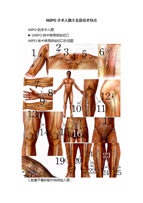 MIPO手术入路大全及技术特点