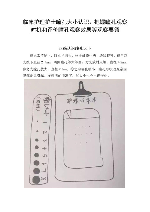 临床护理护士瞳孔大小认识、把握瞳孔观察时机和评价瞳孔观察效果等观察要领