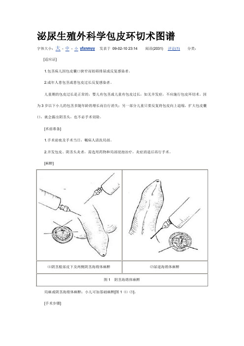 泌尿生殖外科学包皮环切术图谱