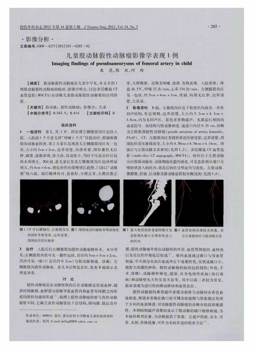 儿童股动脉假性动脉瘤影像学表现1例