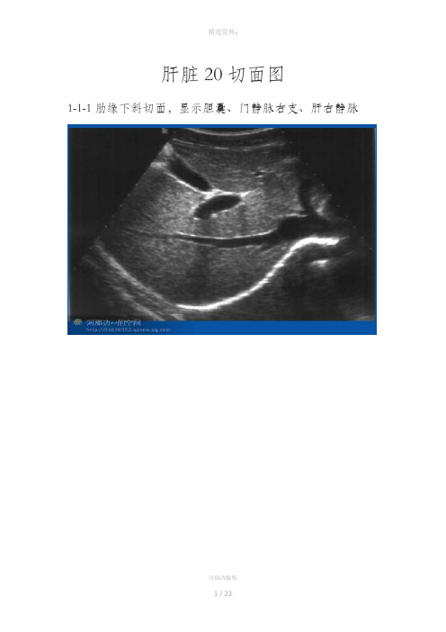 肝脏超声个切面